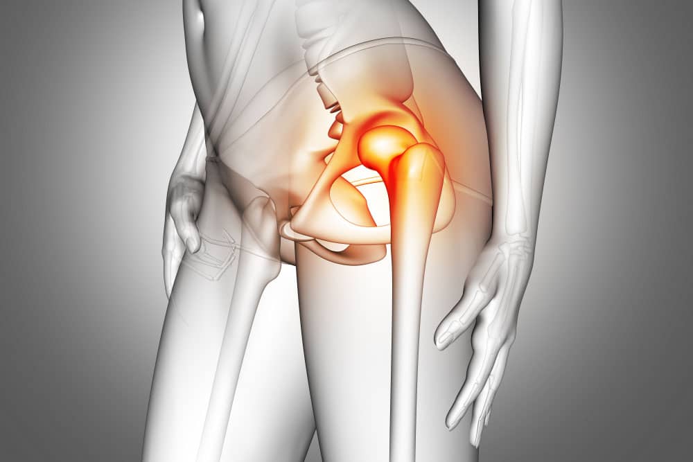 Rehabilitación de Prótesis de Cadera a Domicilio en Madrid